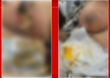 Médico é indiciado por lesão gravíssima após paciente perder mama no DF; cirurgião já havia sido alvo de denúncias em 2019