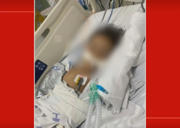 Criança de 1 ano está entubada em UTI após picada de escorpião no DF