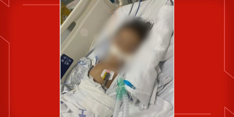 Criança de 1 ano está entubada em UTI após picada de escorpião no DF