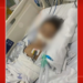 Criança de 1 ano está entubada em UTI após picada de escorpião no DF